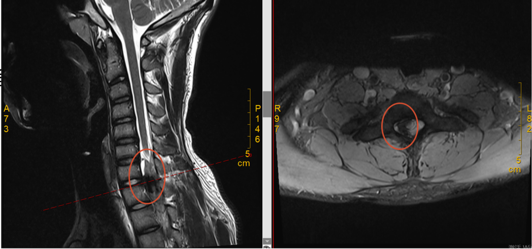 这个病，让高三学子 12 年寒窗苦读差点毁于一旦