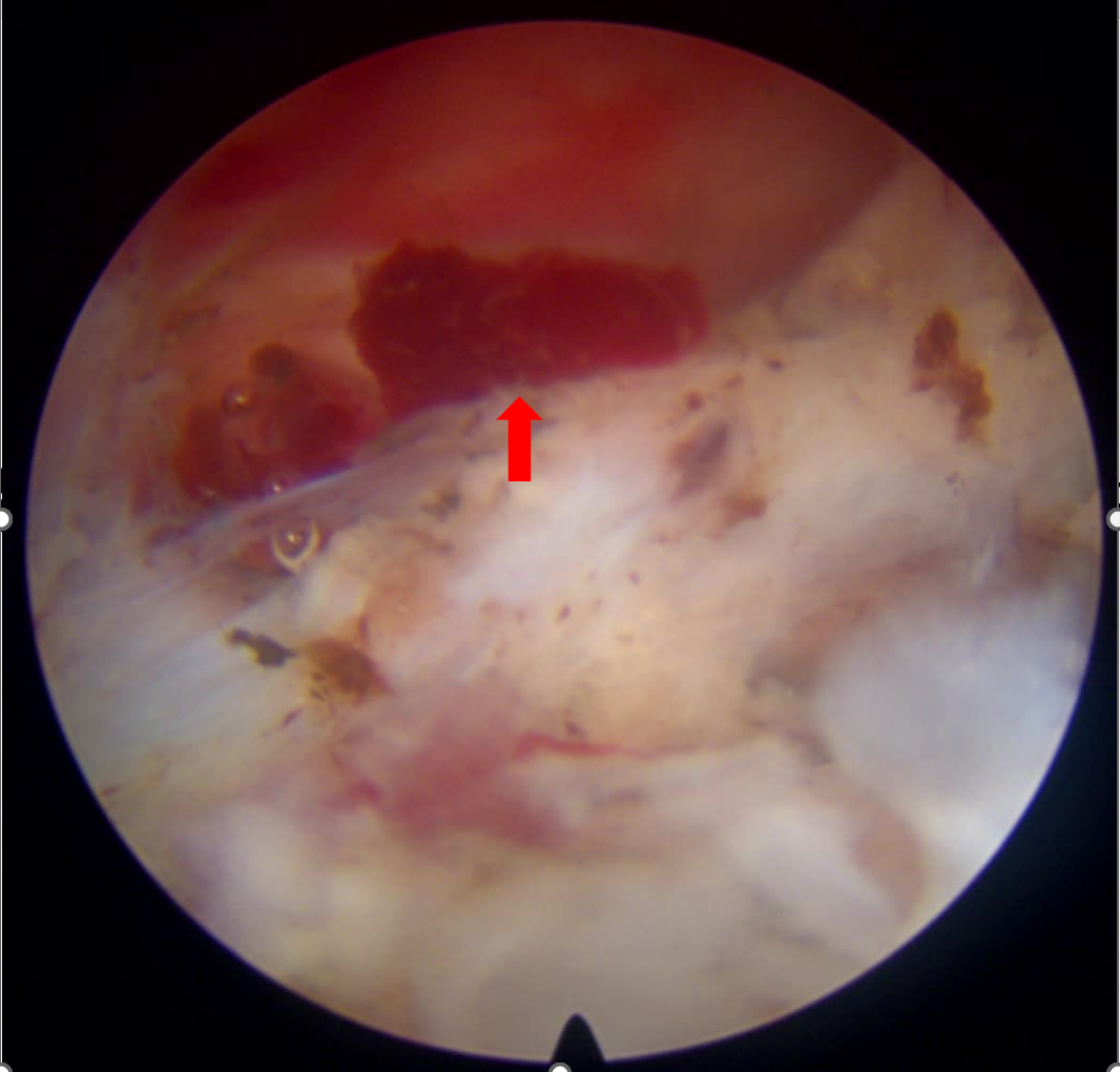 这个病，让高三学子 12 年寒窗苦读差点毁于一旦