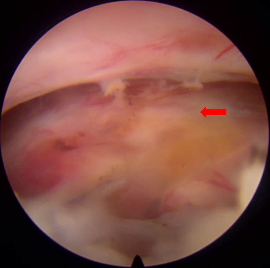 这个病，让高三学子 12 年寒窗苦读差点毁于一旦