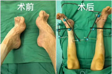 出生即不正常！他，如何隐忍了 60 多年？