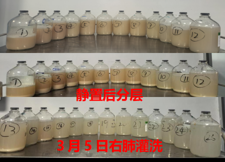 反复胸闷、咳嗽,双肺竟然洗出 40 余瓶脏水!