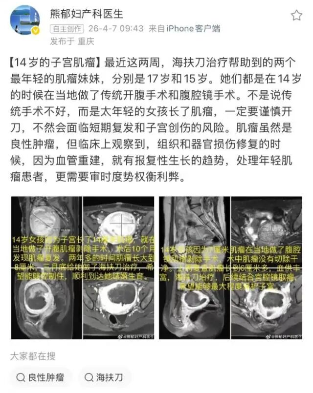 花季遇肌瘤，重庆海扶医院无创护芳华
