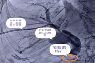 95 岁高龄、急症、休克边缘……多学科如何快速破局？