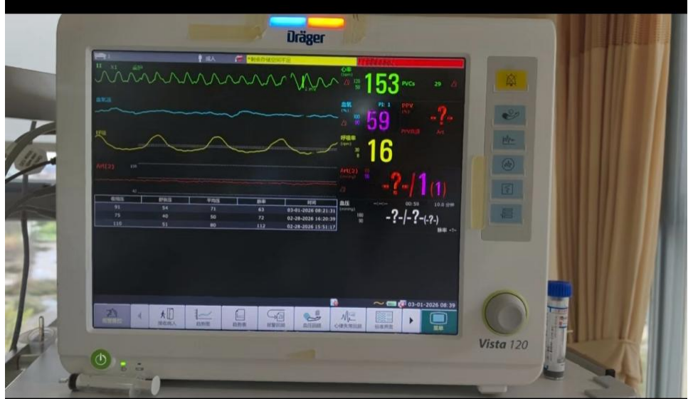 生死时速!桂医一附院以 VA-ECMO 成功挽救暴发性心肌炎老兵