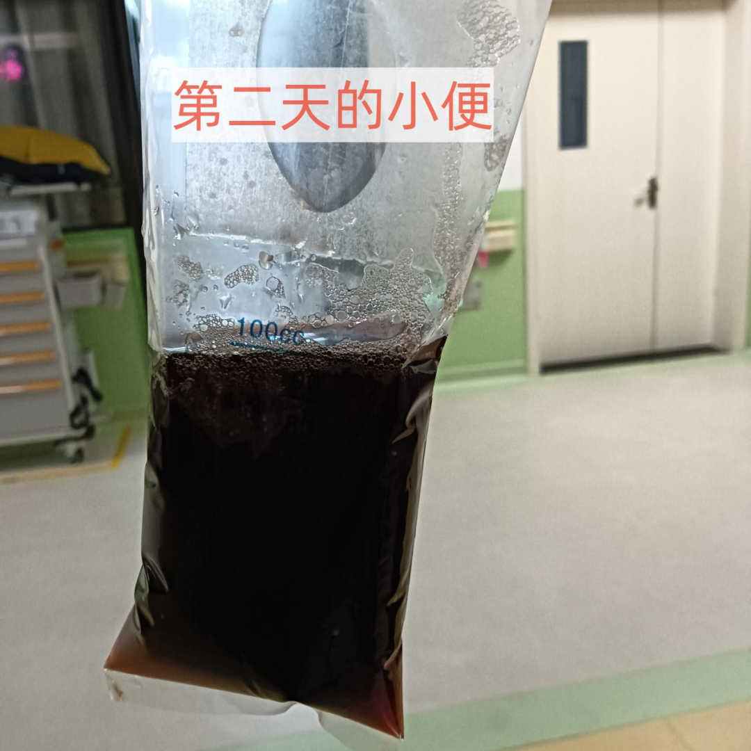 儿科急诊惊魂！孩子只说肚子疼、吐了，医生却发现致命异常