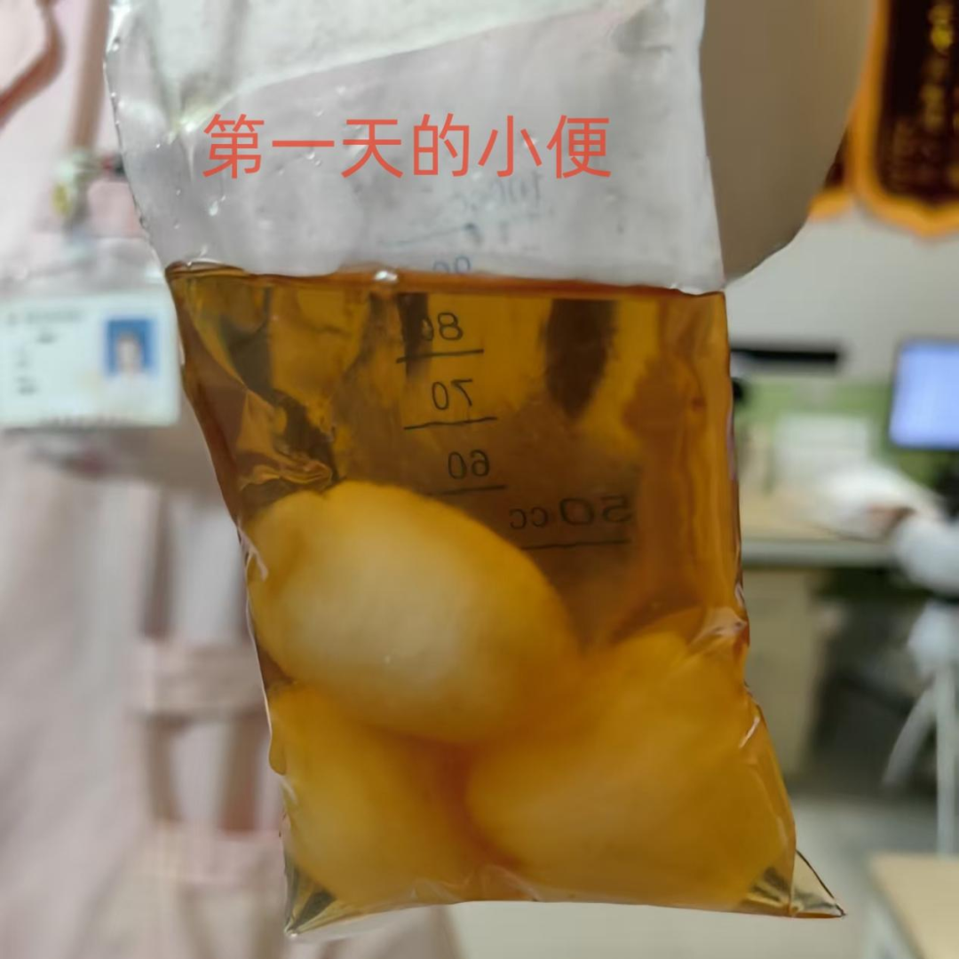 儿科急诊惊魂！孩子只说肚子疼、吐了，医生却发现致命异常