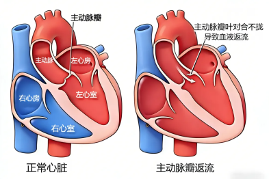 一个全家怕，一个全身病，同一天他们做了同一个手术