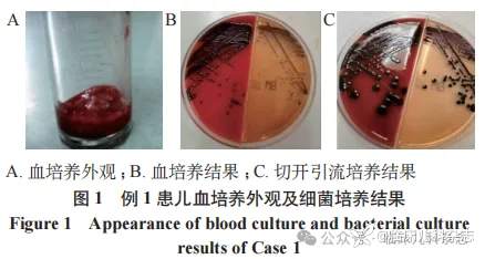 儿童紫色色杆菌感染临床特征及远期预后分析