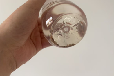 排尿排出「金豆子」！0.9 cm 输尿管结石，不开刀体外冲击波碎石
