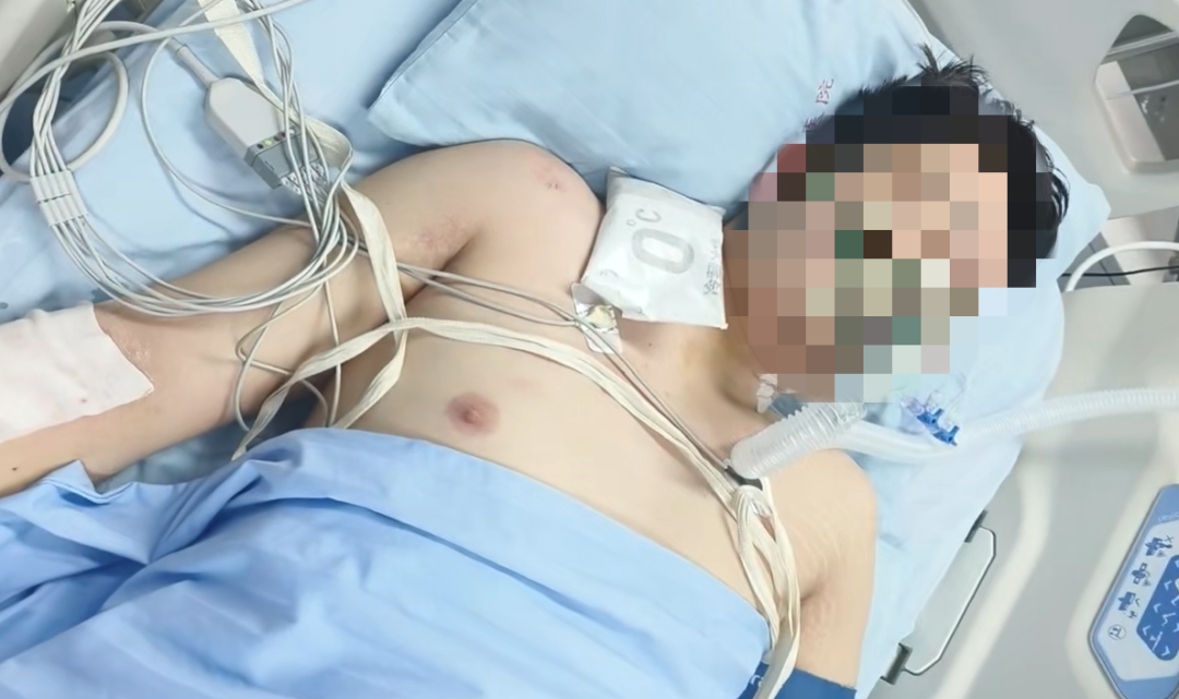 23 岁小伙无攻略去西藏旅游，严重高反险丧命！