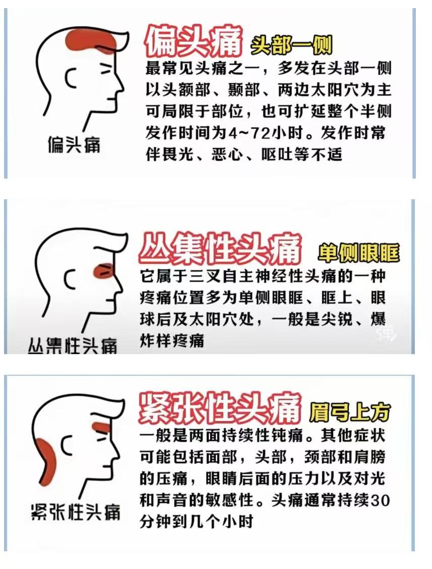 头痛发作,别乱做这 3 件事