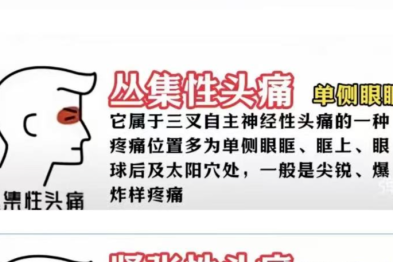 头痛发作，别乱做这 3 件事