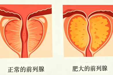 他的心愿：痛快尿一泡