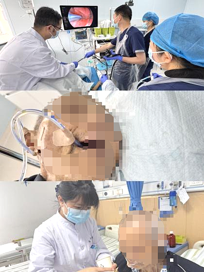 高龄老人反复肠梗阻,胃镜下置入梗阻导管,精准「拆堵」保平安