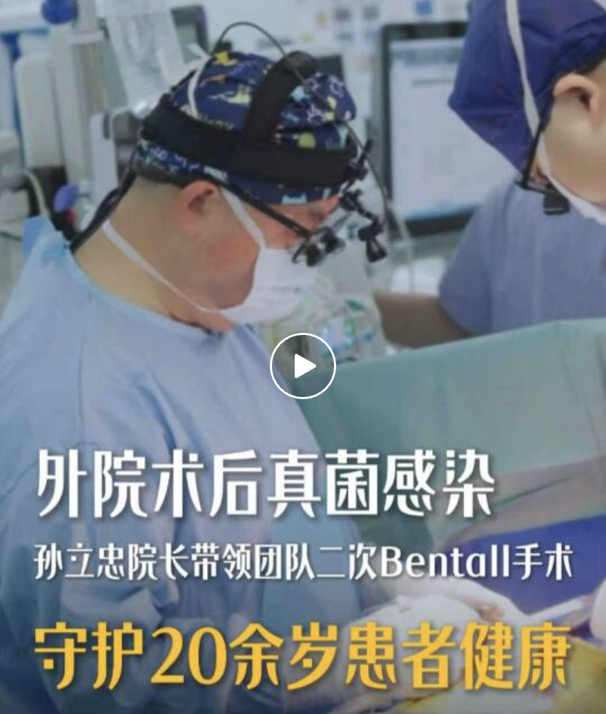 术后真菌感染致瓣周漏,孙立忠院长团队二次 Bentall 手术挽回生命