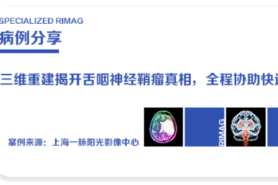 典型案例  |  一脉阳光三维重建揭开舌咽神经鞘瘤真相，全程协助快速衔接临床治疗