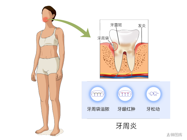 一种会让牙齿掉光的病,年轻人也要重视