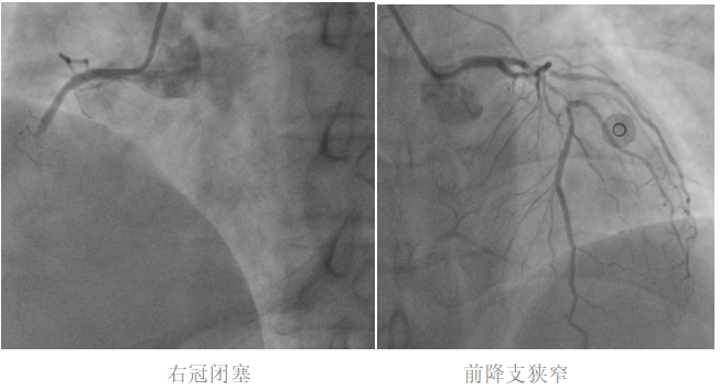 18 分钟!成都京东方医院跑出「救心」加速度