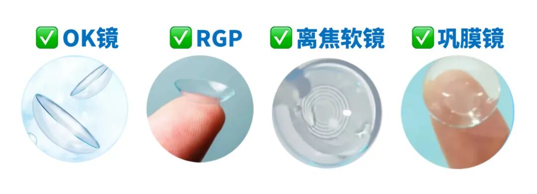 OK 镜、RGP、离焦软镜、巩膜镜大 PK!孩子近视该选哪种?