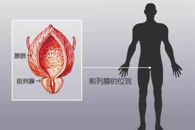 检验科普：前列腺液常规检查