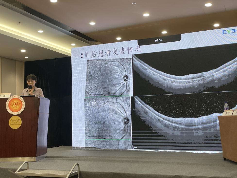 爱尔眼科「闪耀」非公眼科年会：6 名医生入选葡萄膜炎及感染性眼病学组