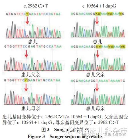 切-希二氏综合征 1 例报告