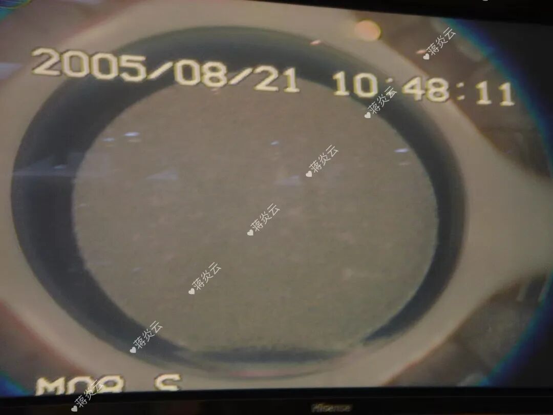 蒋炎云:用匠心点亮患者视界