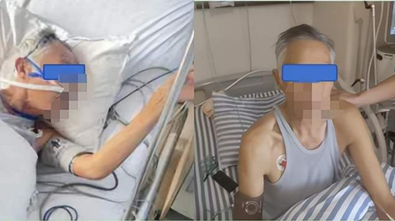 南昌大学二附院携手医联体单位为晚期肺癌患者紧急开通闭塞气道