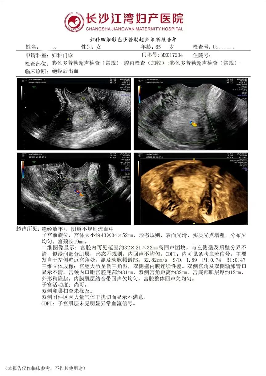花甲之年险遇癌魔，江湾医院微创除瘤护平安。
