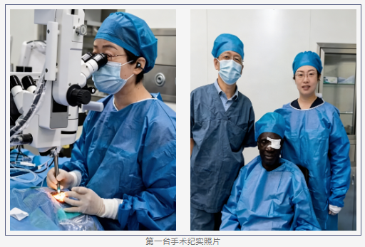 郑州市中心医院眼科医生刘曦援赞期间攻克两例极复杂白内障手术
