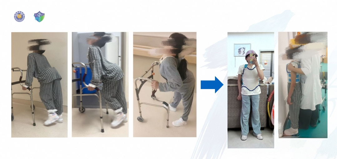 三线告捷!成都京东方医院呼吸康复登上全国舞台