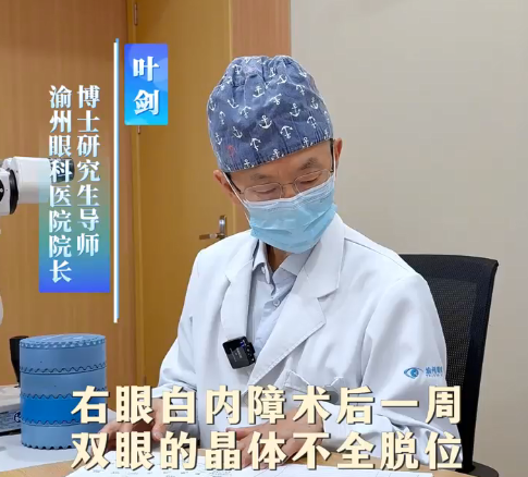 高度近视晶体脱位几近全盲 渝州眼科叶剑教授巧施联合手术为七旬患者挽回光明