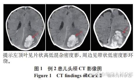 新生儿期起病的遗传性血栓性血小板减少性紫癜 2 例报告