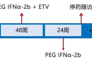 核苷长期治疗仍进展为代偿期肝硬化的慢乙肝患者加用聚乙二醇干扰素α治疗获 HBsAg 血清学转换，肝组织学显著改善