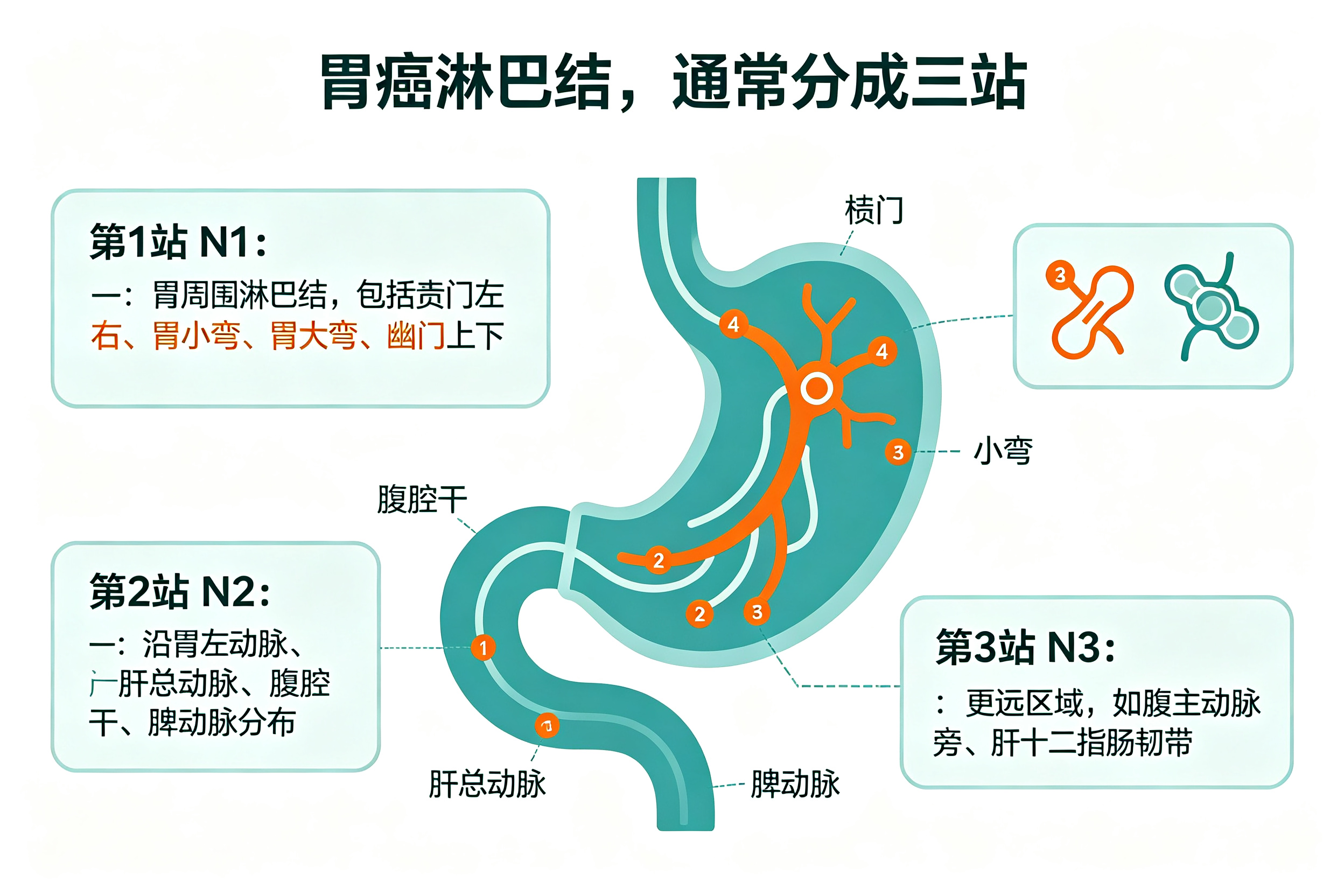 胃癌手术，"清扫淋巴结"比切肿瘤还重要