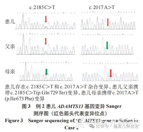 新生儿期起病的遗传性血栓性血小板减少性紫癜 2 例报告