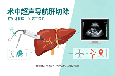 术中超声导航肝切除
