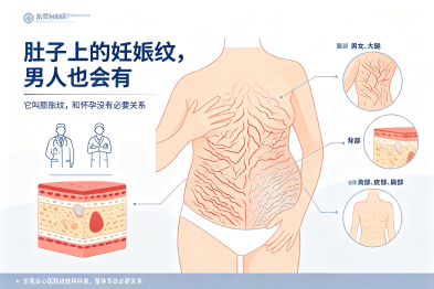 肚子上的"妊娠纹"，男人也会有