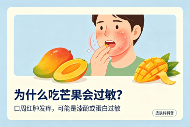 为什么吃完芒果，容易出现过敏反应？