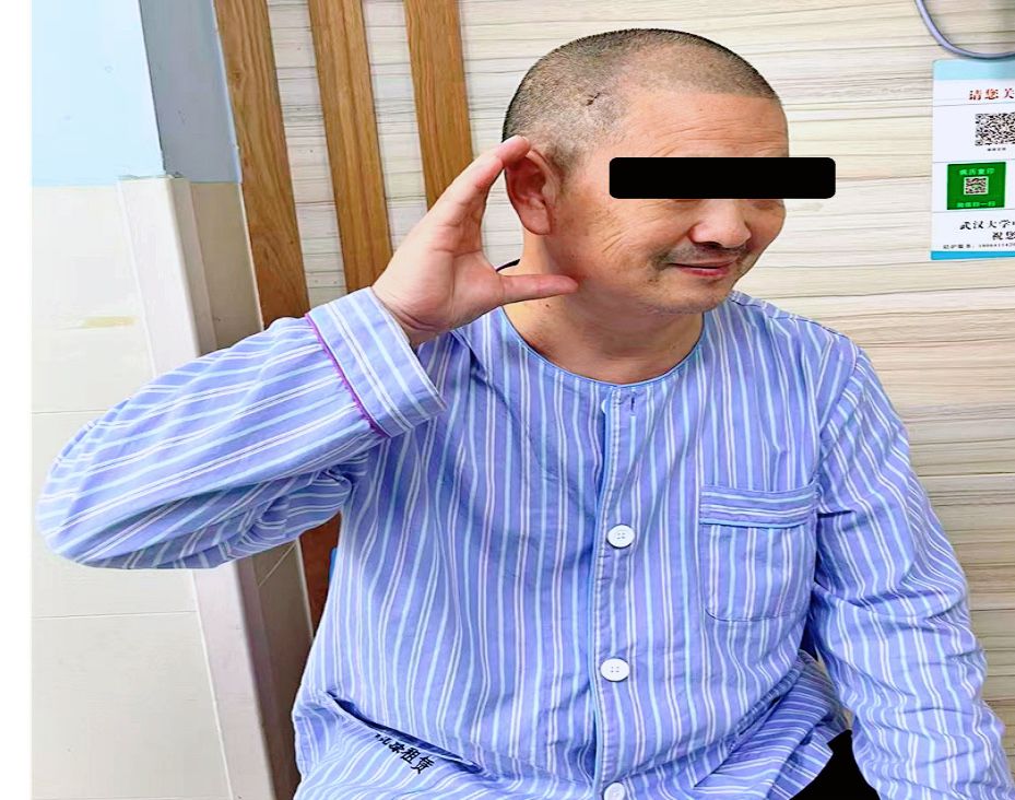 要「微笑」更要「好声音」,武汉专家破解听神经瘤切除难题