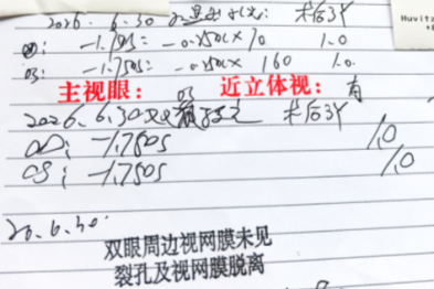 近视激光手术后视力回退怎么办？周跃华教授全面解析二次增效手术