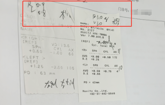 近视激光手术后视力回退怎么办？周跃华教授全面解析二次增效手术