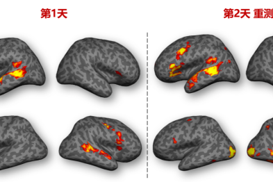 帕金森病、阿尔茨海默病、抑郁症等，常规核磁看不出问题？请关注这张「大脑功能地图」