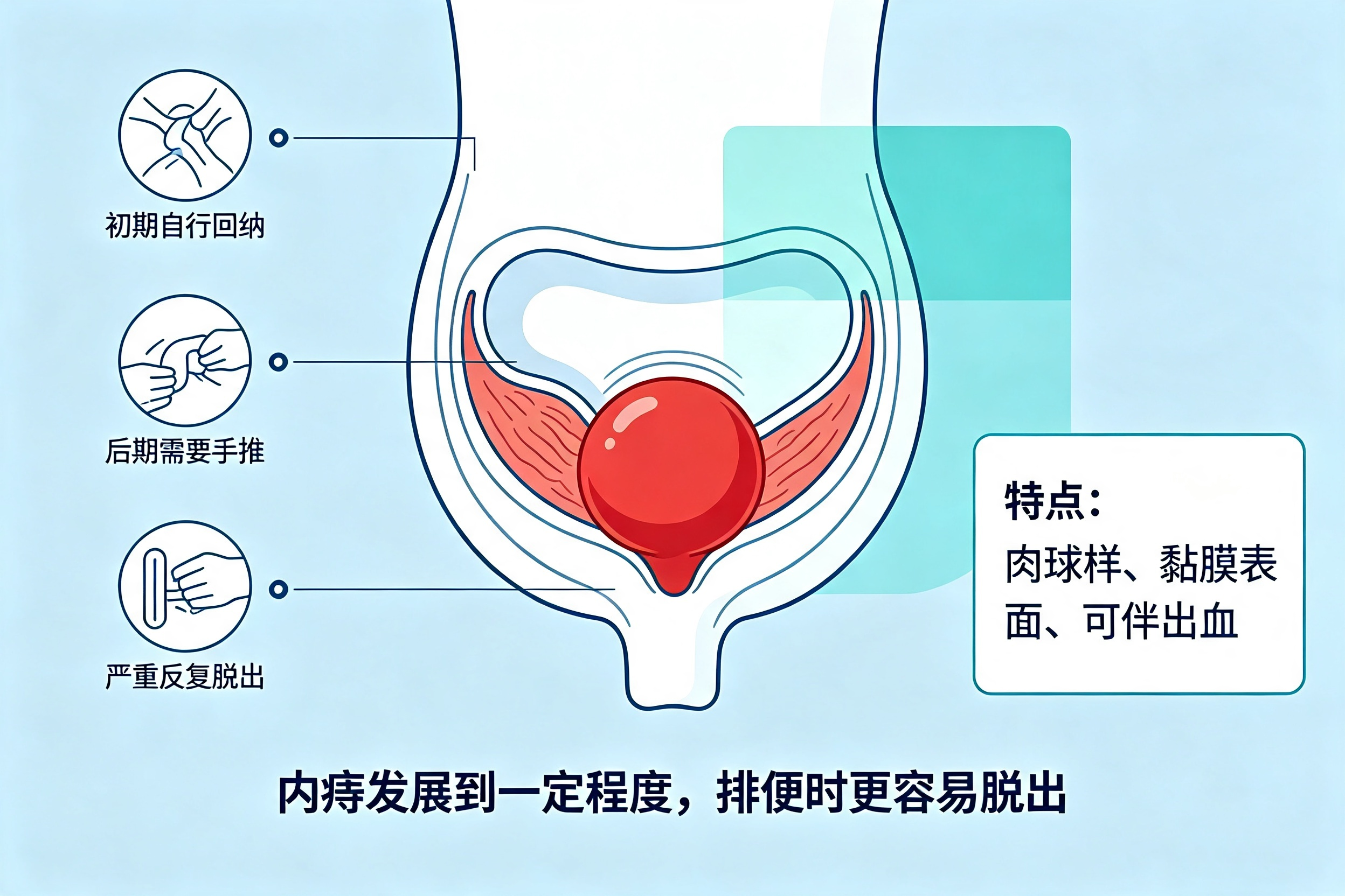 为什么有的人"肛门"会"有东西掉出来"