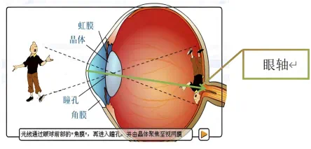 孩子戴眼镜，越戴度数越高？可能是这几个原因...