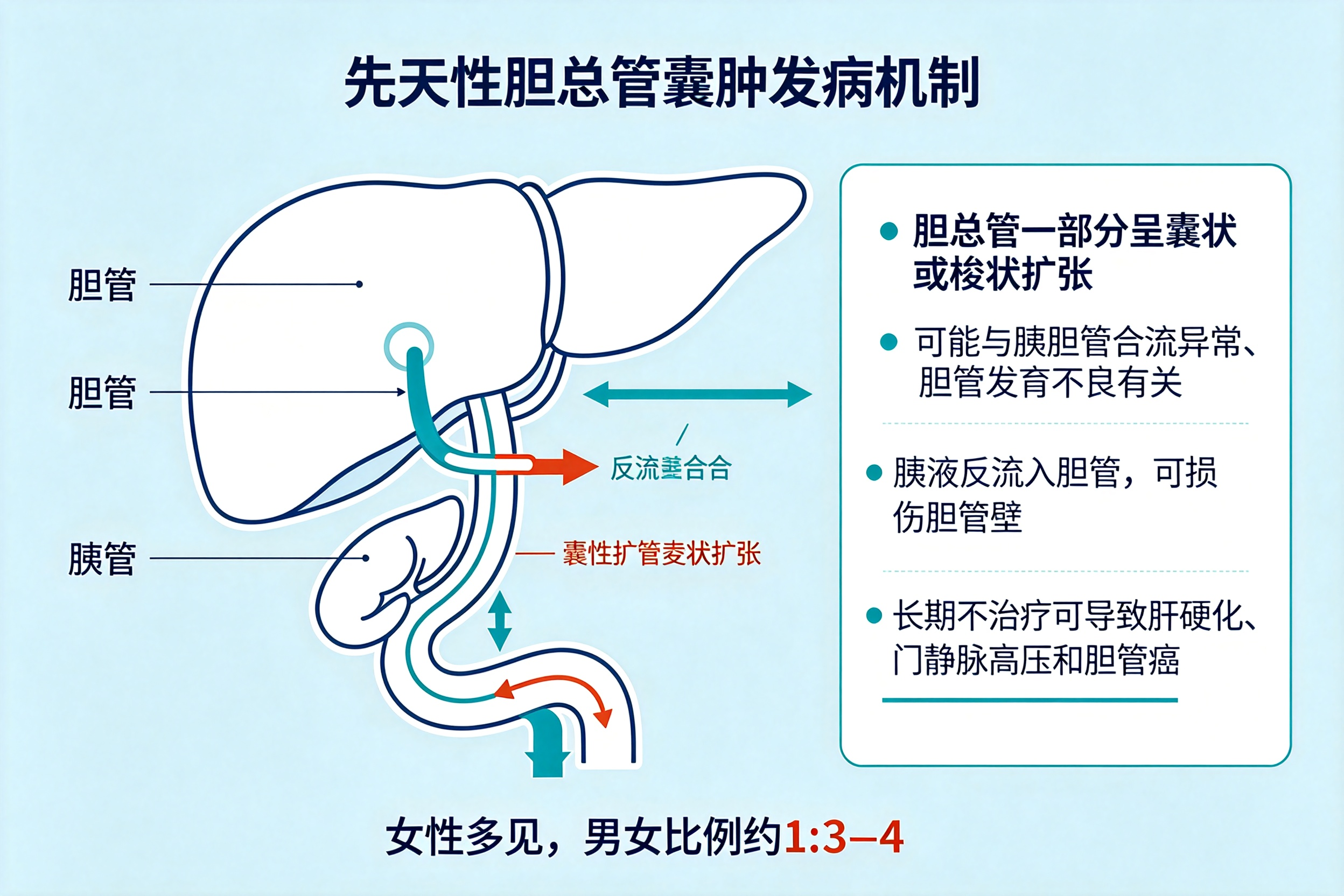 孩子腹痛、黄疸、腹部包块,警惕先天性胆总管囊肿