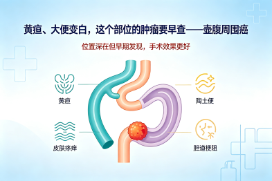 黄疸、大便变白，这个部位的肿瘤要早查——壶腹周围癌
