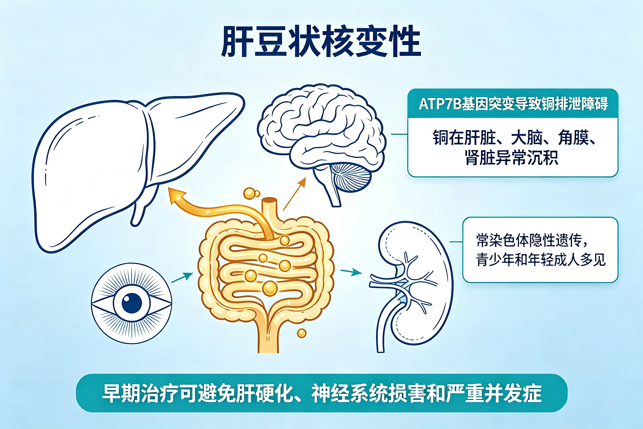年轻人肝不好，警惕这个遗传病——肝豆状核变性