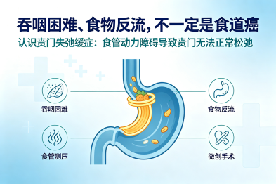吞咽困难、食物反流，不一定是食道癌——认识贲门失弛缓症