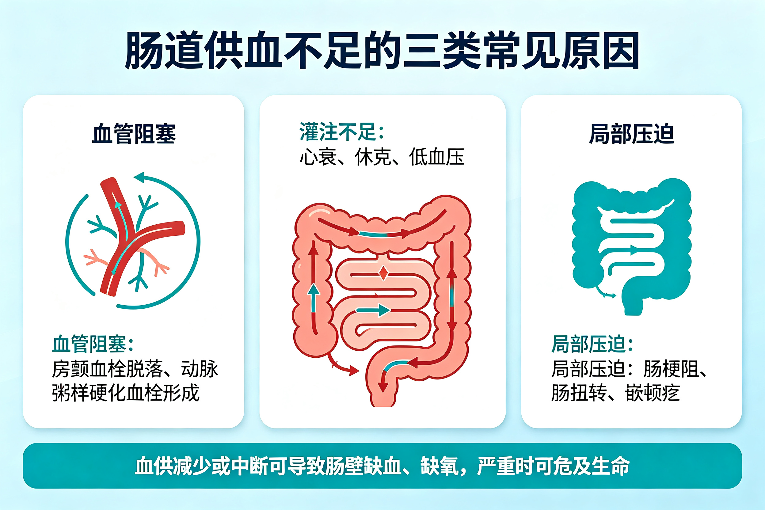 肚子突然剧痛,警惕肠道"中风"——缺血性肠病